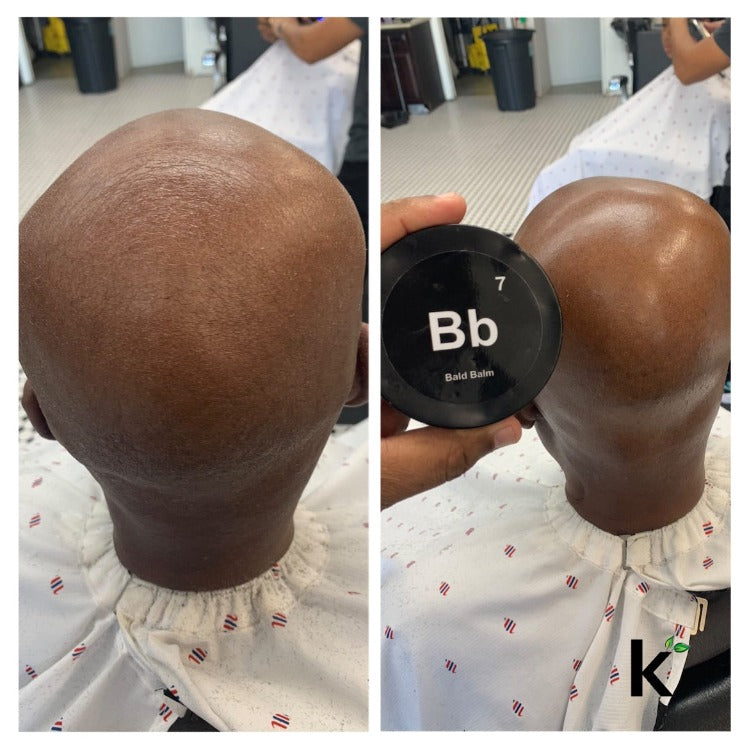 Bald Balm